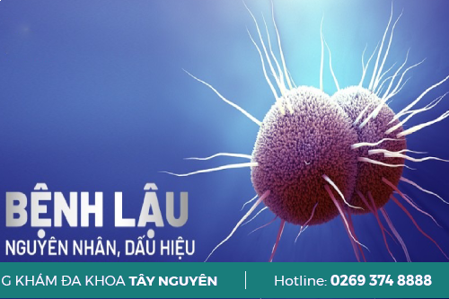 benh-lau-u-benh-bao-lau-thi-co-nguy-co-phat-benh