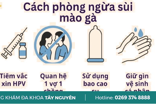Cách Đề Phòng Sùi Mào Gà Tái Phát Như Thế Nào Hiệu Qủa Gia Lai