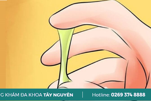 Địa Chỉ Chữa Khí Hư Huyết Trắng Ra Nhiều Có Màu Vàng Tại Gia Lai