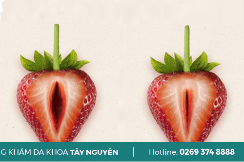 Địa Chỉ Chữa Thu Hẹp Âm Đạo Uy Tín Pleiku Gia Lai