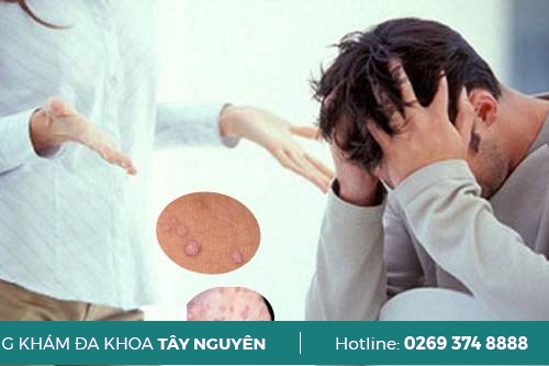 Tại sao nên tư vấn bệnh xã hội sớm? Tại sao nên tư vấn bệnh xã hội sớm?