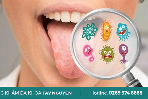 Điều Trị Bệnh Lậu Tái Phát Như Thế Nào Gia Lai? Điều Trị Bệnh Lậu Tái Phát Như Thế Nào Gia Lai?