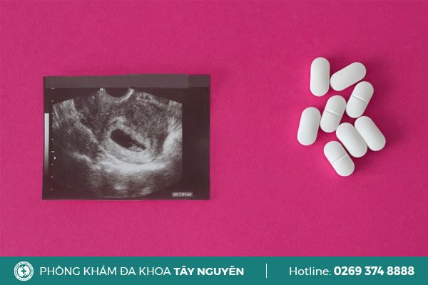 Thai phụ thực hiện kiểm tra thai 2 tuần muốn phá sẽ làm như thế nào?