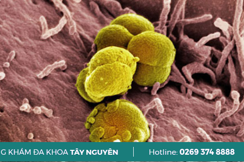 Vi Khuẩn Lậu Sống Ở Đâu Và Tồn Tại Sống Được Bao Lâu Gia Lai